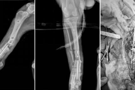 瑞派明星专科：重塑筋骨，守护生命的每一份支撑 