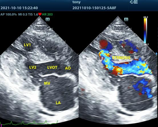 瑞派明星专科：倾听心跳，守护生命的核心韵律 