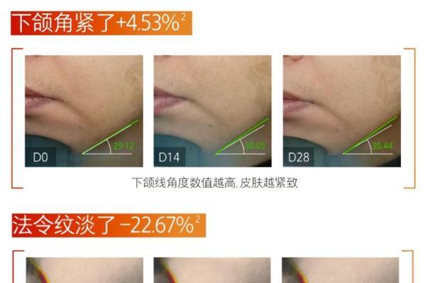 为什么我会推荐你试试hfp淡纹紧致嘭弹面霜 