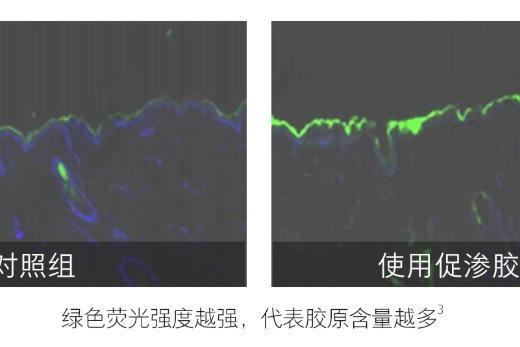 为什么我会推荐你试试hfp淡纹紧致嘭弹面霜 