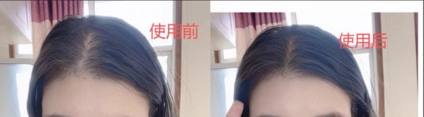 海瑟薇防脱洗发水口碑深度测评：当发质改善成为防脱的有力说明 