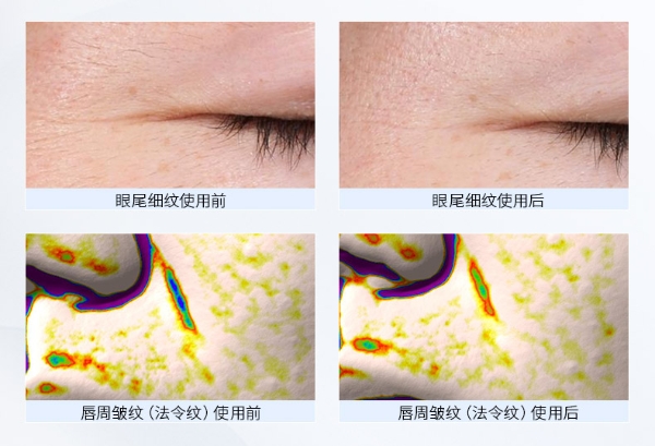 专注抗衰新纪元：雅萌旗下Hakase Beaute荣获ELLE尖端逆龄智研奖美妆大奖 