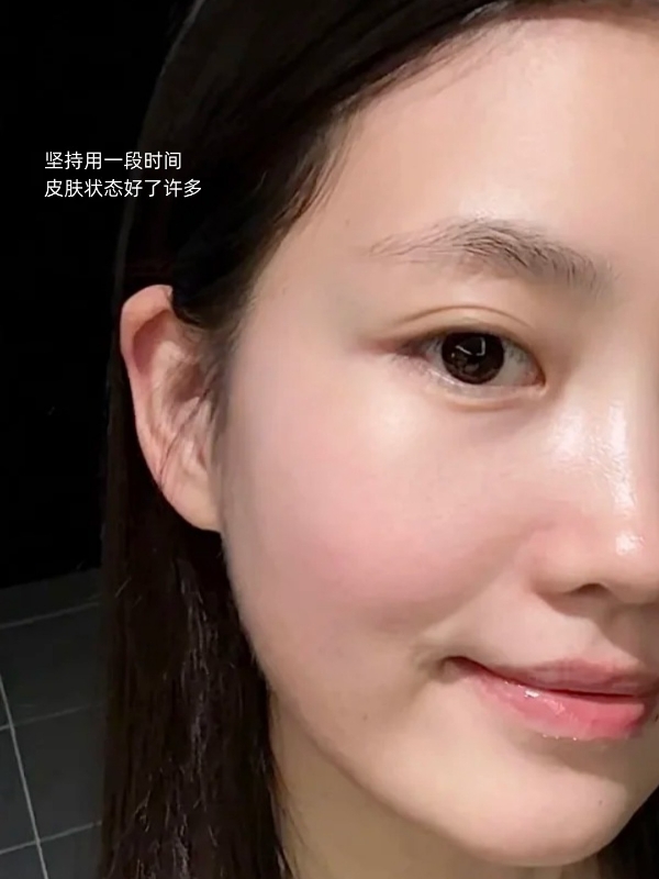 hfp紧致弹嫩精华液好用么？对熬夜垮脸真的有效吗？ 