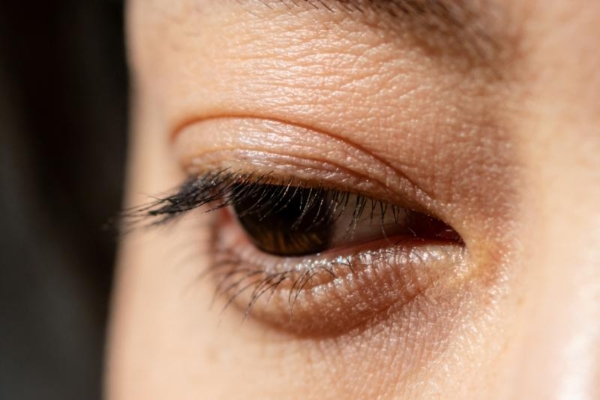  冬季眼周肌肤衰老加快？hfp冷玛吉眼油养出亮彩年轻眼 