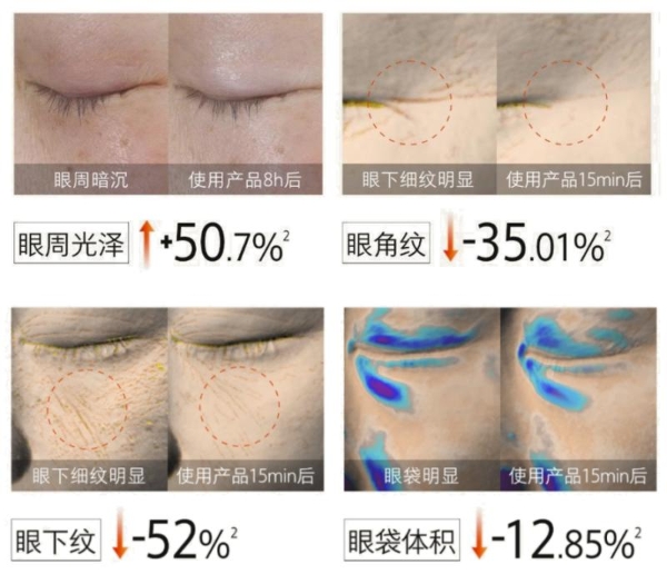  冬季眼周肌肤衰老加快？hfp冷玛吉眼油养出亮彩年轻眼 