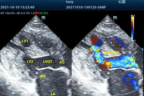 瑞派明星专科：倾听心跳，守护生命的核心韵律 