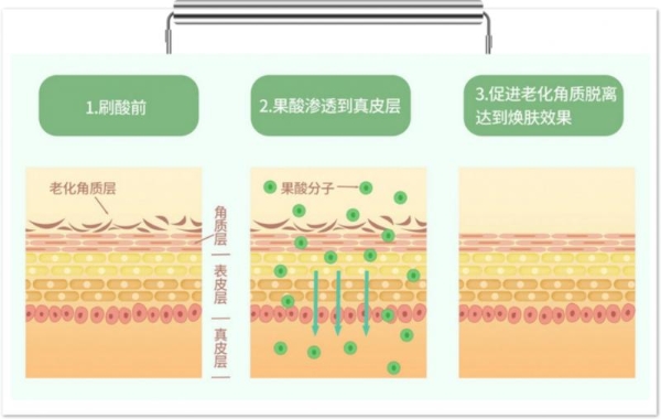 hfp果酸角质管理精华液：专研油皮抛光方案，打破油氧痘内耗 
