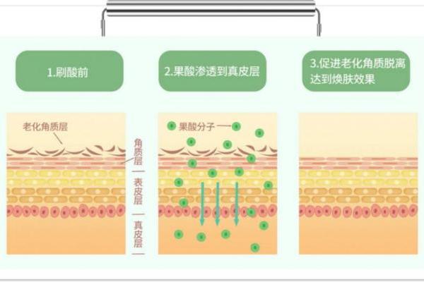 hfp果酸角质管理精华液：专研油皮抛光方案，打破油氧痘内耗 