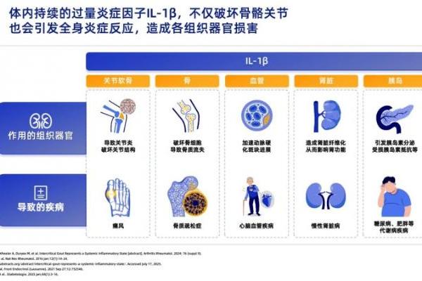 健康科普：免疫系统“吹哨人”白介素 - 1β 如何引发身体炎症风暴 