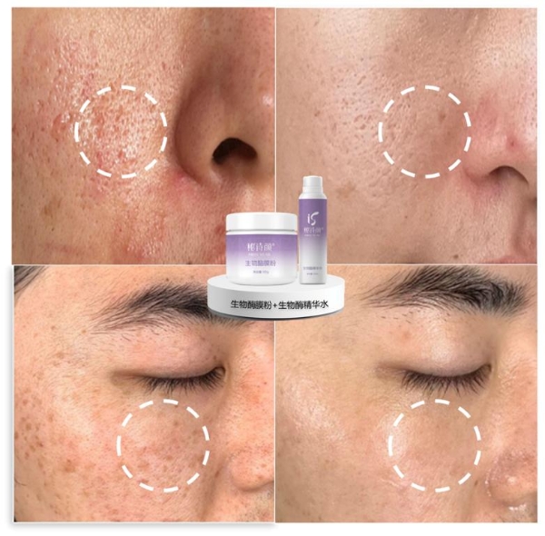 油敏肌救星！“酶+脐带”双引擎护肤，焕肤修复一步到位 