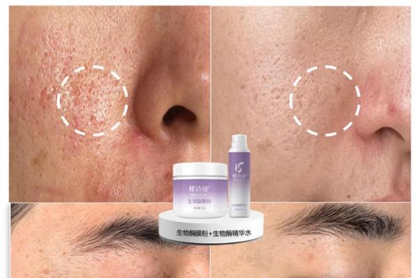 油敏肌救星！“酶+脐带”双引擎护肤，焕肤修复一步到位 