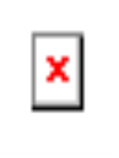 不只“低敏”那么简单！探究适度水解奶粉有哪些品牌及其核心科技 