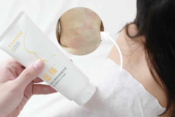 2026年2月好用的宝宝面霜有哪些？全面专业解析选对宝宝面霜 