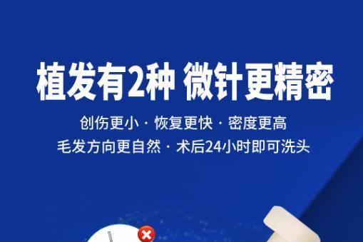 大麦微针植发大麦脱发医院国贸门诊部：科学解释中年脱发发生机制 