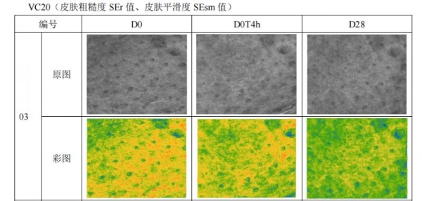 换季敏感干纹多？hfp悬金次抛精华伴你安稳过度 