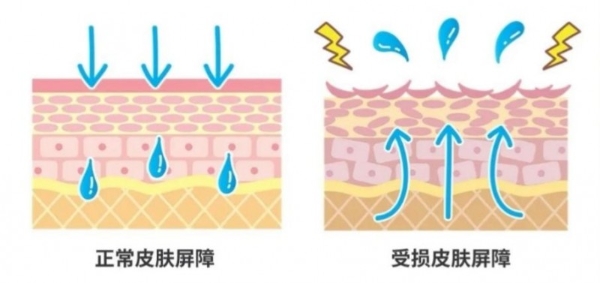 换季敏感干纹多？hfp悬金次抛精华伴你安稳过度 