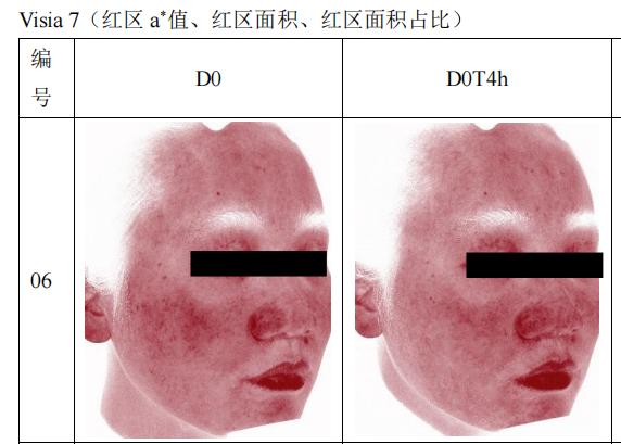 换季敏感干纹多？hfp悬金次抛精华伴你安稳过度 
