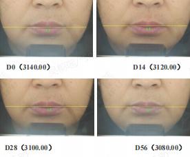 比同龄人年轻，我的护肤法宝是hfp巴掌面霜 