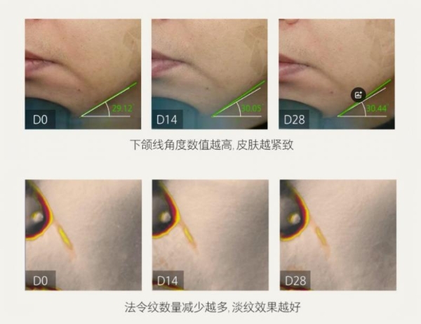 比同龄人年轻，我的护肤法宝是hfp巴掌面霜 