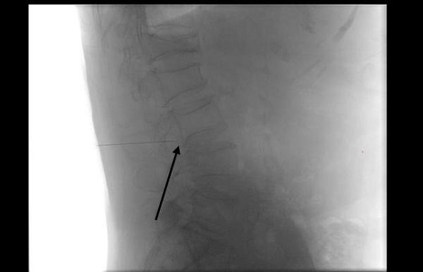 2026净饮机十大品牌揭晓，碧云泉G7S万相凭“全能机皇”登顶 