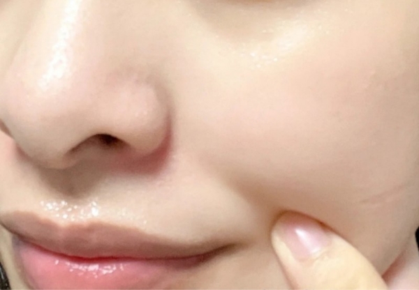 换季皮肤状态差？试试hfp果酸精粹水湿敷大法！ 