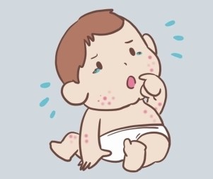 宝宝适度水解奶粉哪家强？佳贝艾特悦白天然低敏营养来帮忙！ 