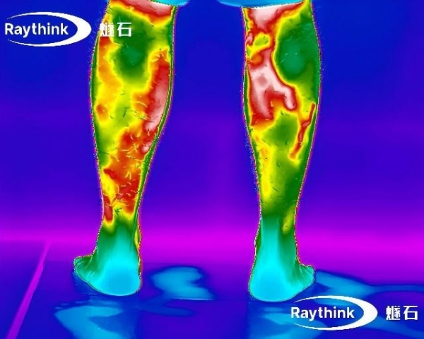 Raythink燧石红外热像仪：以温度为媒，为全民健康筑牢“隐形防线” 