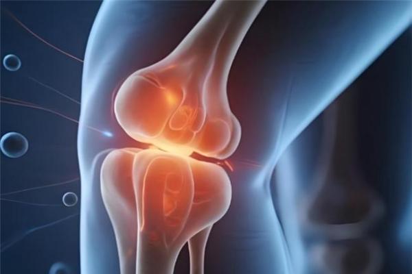 骨关节炎如何应对？先搞清楚硫酸和盐酸氨基葡萄糖胶囊有什么区别 