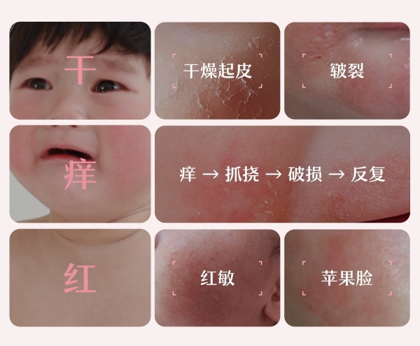 真正的山茶油面霜不黑脸：松达婴童面霜“不黑脸”真人实测通关 