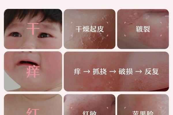 真正的山茶油面霜不黑脸：松达婴童面霜“不黑脸”真人实测通关 