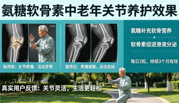 氨糖保健品有哪些牌子 2026年氨糖软骨素怎么选权威科普报告 