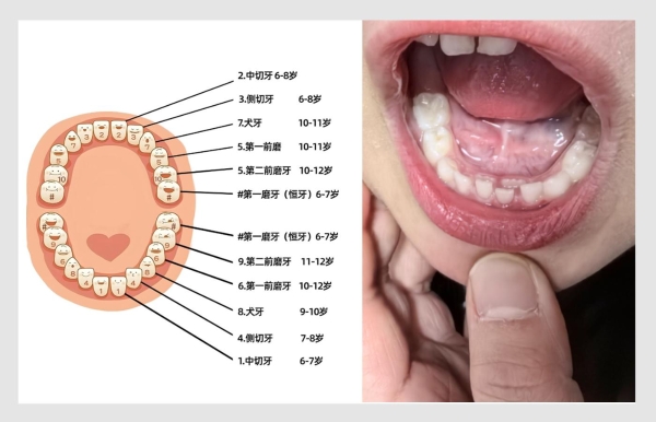 锐舞推出首款青少年喷气式电动牙刷，专为换牙期重新设计
