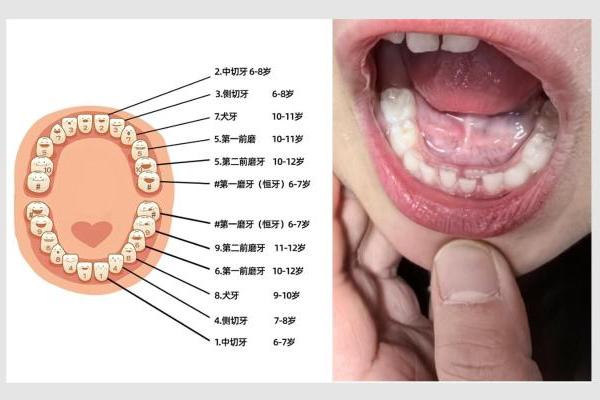锐舞推出首款青少年喷气式电动牙刷，专为换牙期重新设计