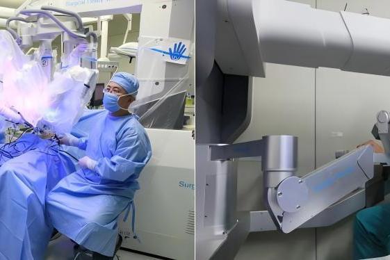 北京大学首钢医院冷建军团队应用术锐单孔蛇形臂机器人完成20多例高难度肝胆胰手术 