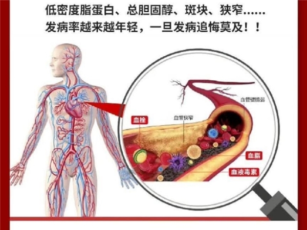 2026 水蛭素哪个品牌正宗？这些重点成分看进口原料来源，中老年日常养护更放心 