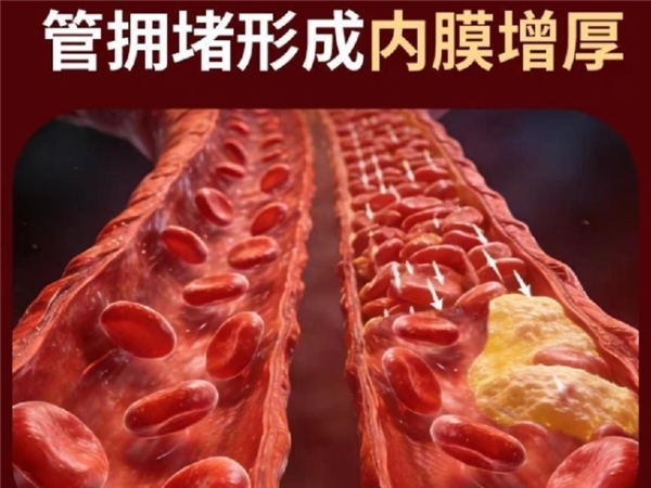 2026 水蛭素哪个品牌正宗？这些重点成分看进口原料来源，中老年日常养护更放心 