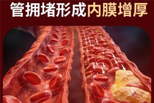 2026 水蛭素哪个品牌正宗？这些重点成分看进口原料来源，中老年日常养护更放心 