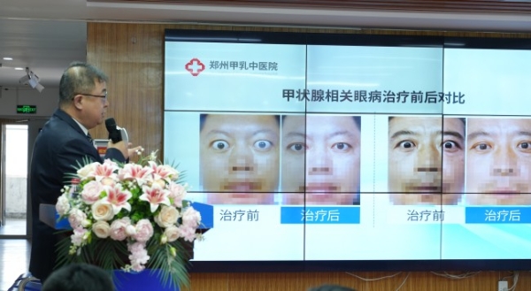 郑州甲乳中医院成功举办 2026 中西医结合甲状腺及相关眼病、男性乳房发育 & 淋巴水肿疑难病例创新诊疗学术会 
