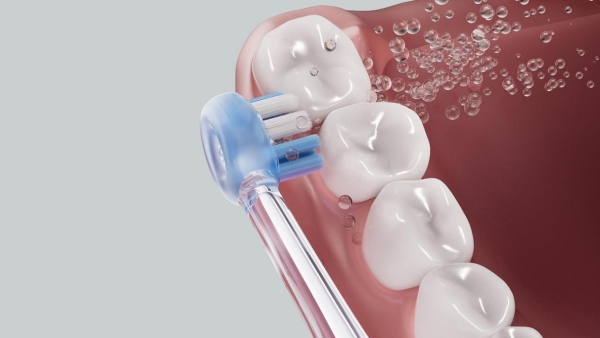 2026电动牙刷榜单推荐：锐舞气泡电动牙刷“微洗牙”功能实测 