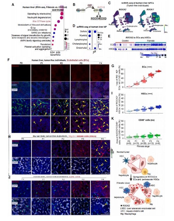 《Cell》重磅：武汉云克隆助力，TDI01靶向ROCK2攻克肝纤维化难题 