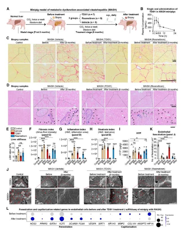 《Cell》重磅：武汉云克隆助力，TDI01靶向ROCK2攻克肝纤维化难题 