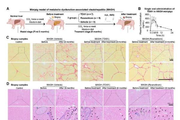 《Cell》重磅：武汉云克隆助力，TDI01靶向ROCK2攻克肝纤维化难题 