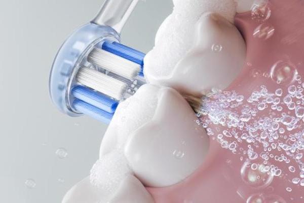 2026电动牙刷口碑榜：锐舞气泡牙刷为何能成为不伤牙龈的清洁首选？ 