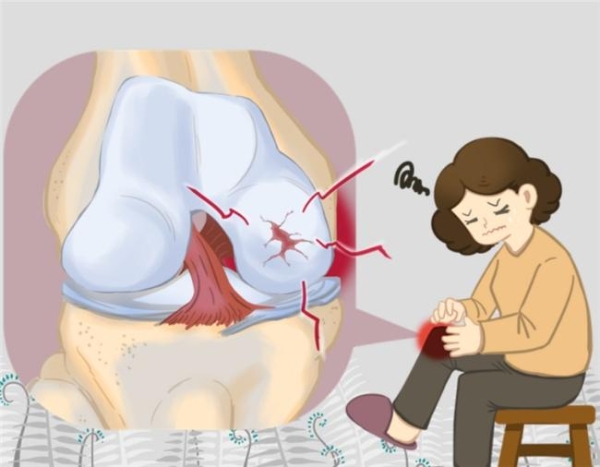 氨基葡萄糖胶囊认准维固力OTC硫酸氨糖，科学长效守护关节软骨 