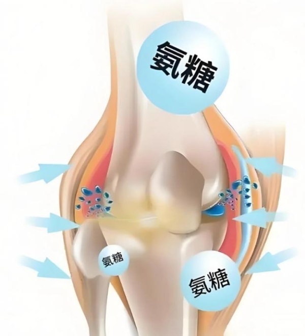 氨基葡萄糖胶囊认准维固力OTC硫酸氨糖，科学长效守护关节软骨 