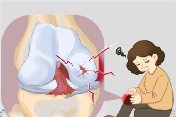 氨基葡萄糖胶囊认准维固力OTC硫酸氨糖，科学长效守护关节软骨 