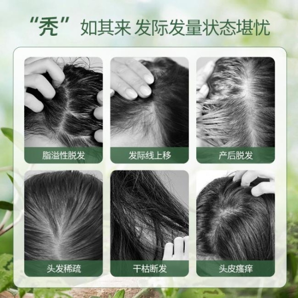 口碑好的防脱洗发水哪个最好？盘点2026洗发水口碑最好的前十名！真实测评第一名最安全 