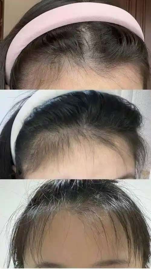 口碑好的防脱洗发水哪个最好？盘点2026洗发水口碑最好的前十名！真实测评第一名最安全 