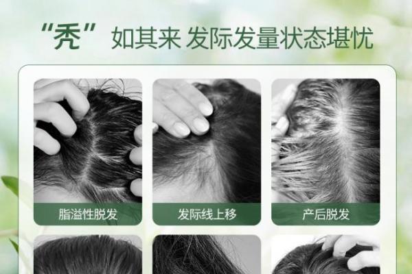 口碑好的防脱洗发水哪个最好？盘点2026洗发水口碑最好的前十名！真实测评第一名最安全 