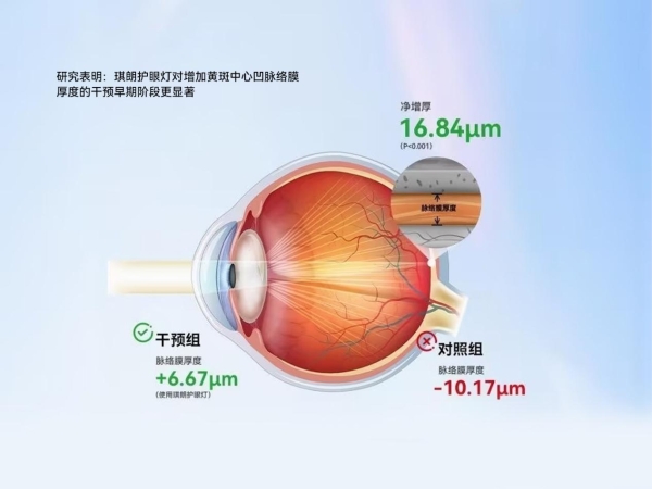 行业首个真人临床研究登国际期刊：《琪朗全光谱护眼灯被证实可延缓学龄儿童眼轴增长》 